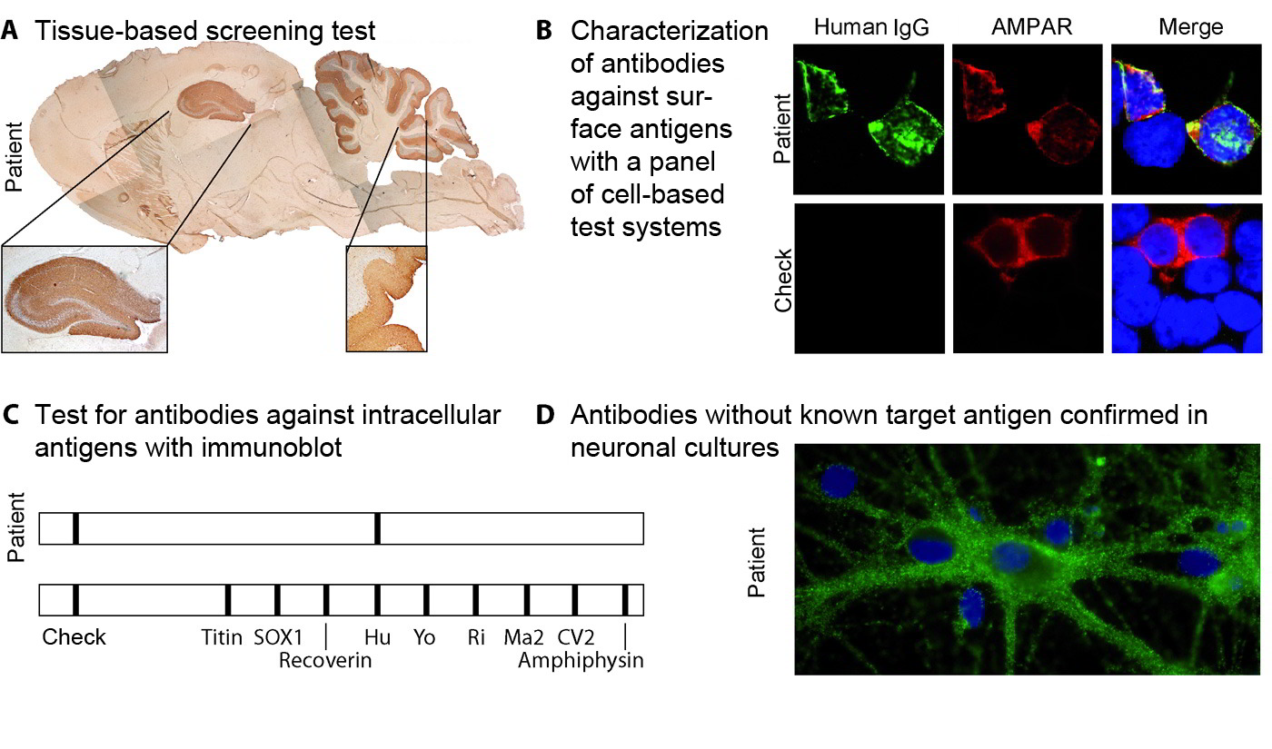 How are neuronal antibodies detected? GENERATE GErman NEtwork for